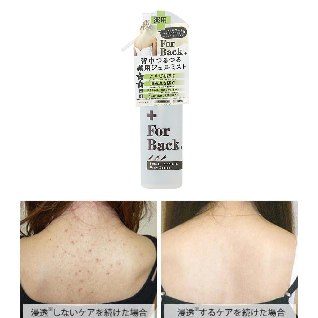 Gel xịt mụn lưng For Back 100ml, ngăn ngừa mụn hiệu quả
