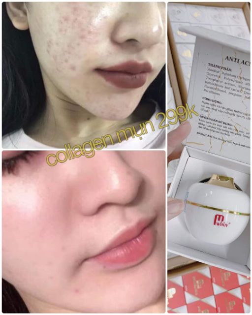 FACE TRUYỀN TRẮNG COLLAGEN MWHITE | BigBuy360 - bigbuy360.vn