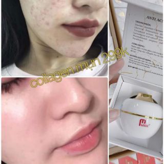 FACE TRUYỀN TRẮNG COLLAGEN MWHITE