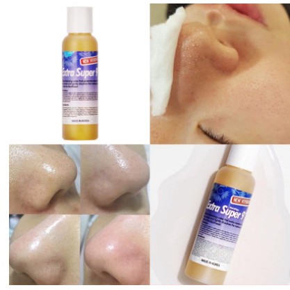 Dung Dịch Ủ Làm Sạch Mụn Đầu Đen Mụn Cám Mụn Trứng Cá Medipeel Extra Super 9+ 50ml - 100ml - Cao Cấp Chính Hãng