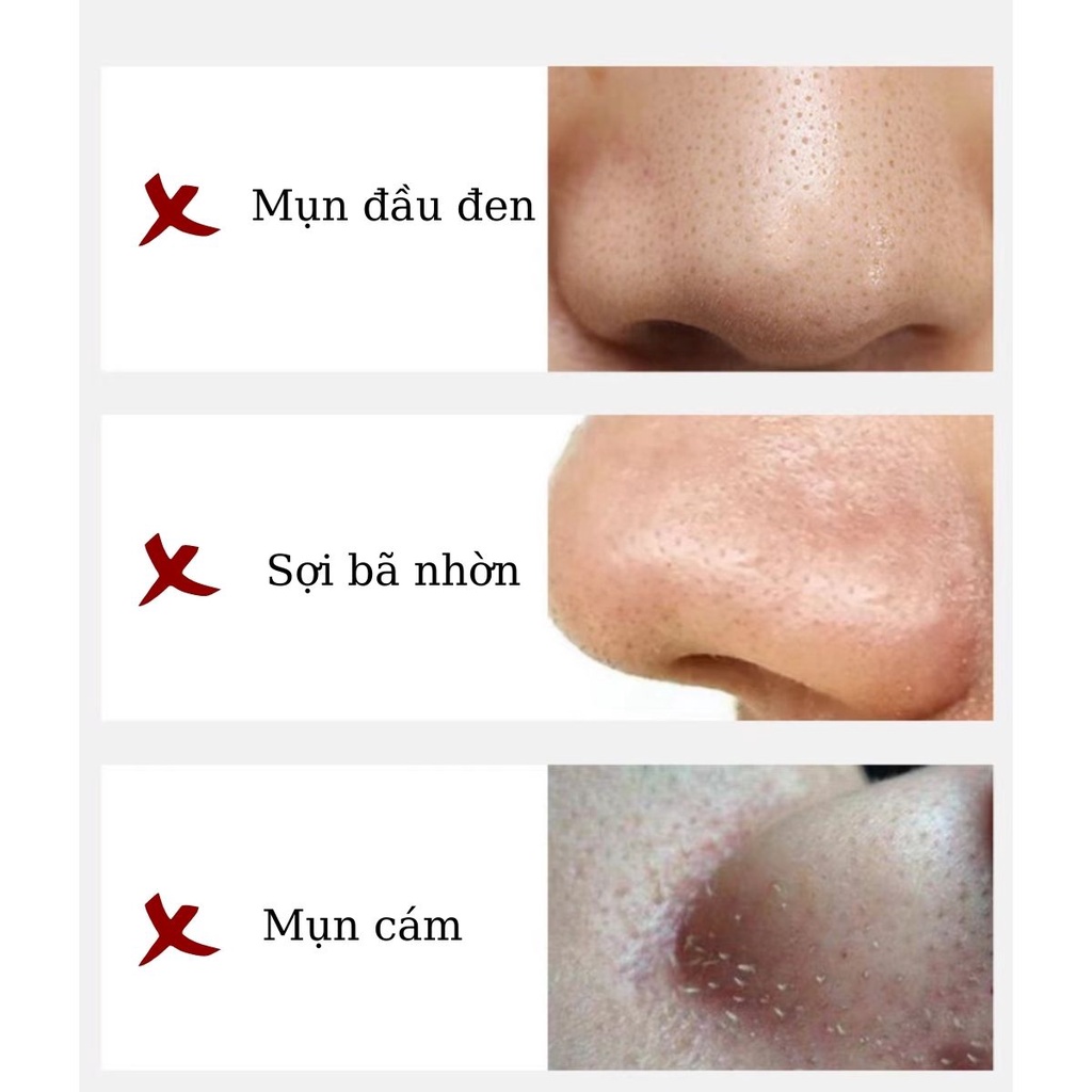 Mặt Nạ Lột Mụn THAN TRE TRÀ XANH Hỗ Trợ Giảm Mụn Cám Đầu Đen Trắng Da Nội Địa Trung