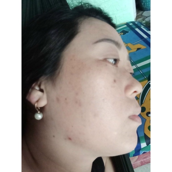 Serum thảo dược mụn may new tái tạo da