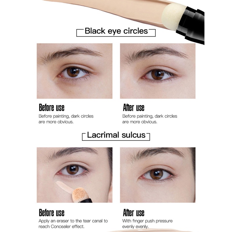 Thỏi Kem Che Khuyết Điểm Kháng Nước Dưỡng Ẩm Che Phủ Mụn Và Nhược Điểm Cho Da