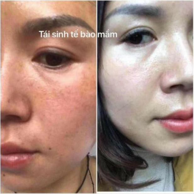 [Chuẩn Hàn]BỘ TÁI SINH TẾ BÀO MẦM