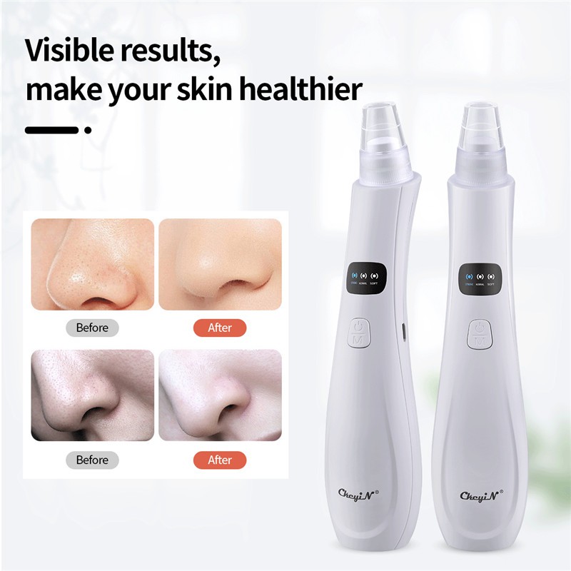 CKEYIN Máy hút mụn đầu đen  làm sạch lỗ chân lông kèm 5 đầu hút chuyên dụng MR596W