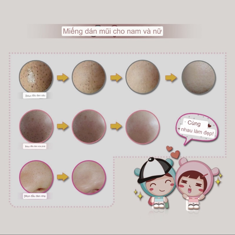 Sét lột mụn 3 bước chuyên sâu Bioaqua than hoạt tính, sạch mụn và chăm sóc da vùng mụn, lột mụn cám nhanh