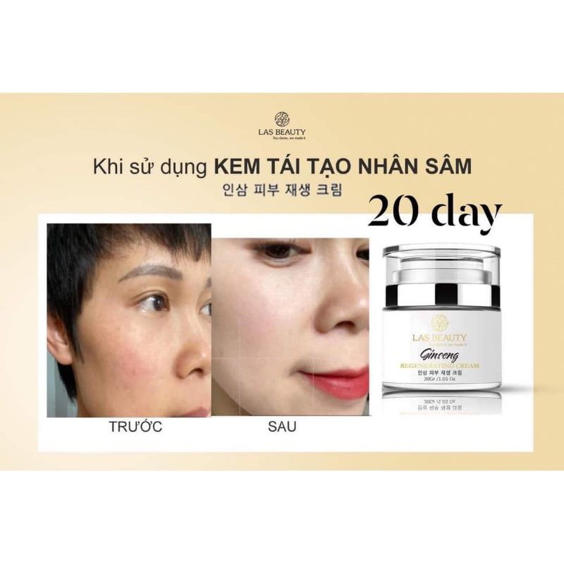 KEM TÁI TẠO DA NHÂN SÂM LAS BEAUTY TỪ HÀN QUỐC | BigBuy360 - bigbuy360.vn