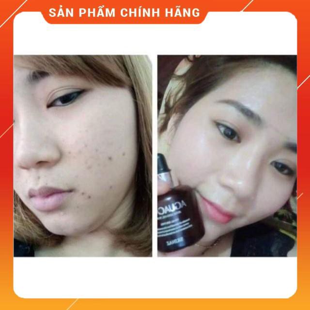 TINH CHẤT BƠ DƯỠNG DA KHỎE CĂNG BÓNG SÁNG HỒNG SKINAZ HÀN QUỐC [SP chính hãng]