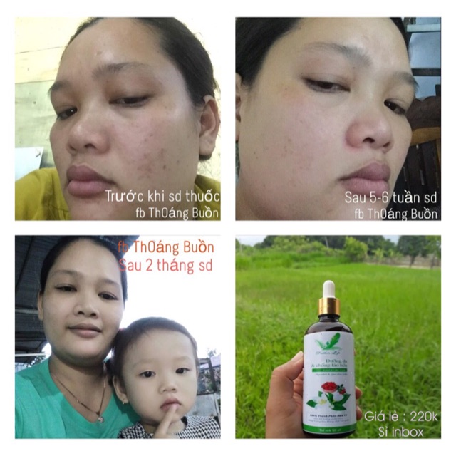 THUỐC BẮC TÁI TẠO DA