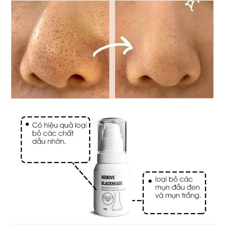 Ủ Mũi Xử Lý Mụn đầu đen Removes Blackheads 50ml