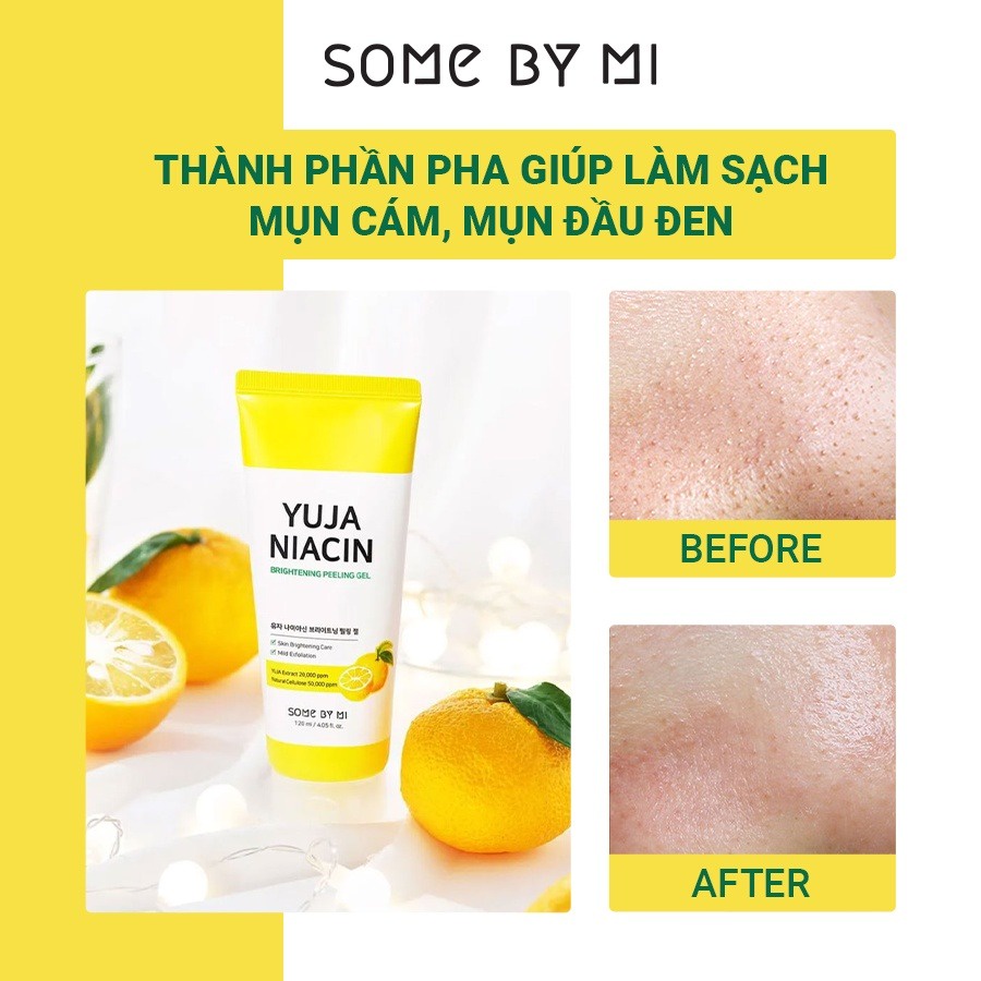 Gel Tẩy Da Chết, Dưỡng Trắng Da Some By Mi Yuja Niacin Brightening Peeling Gel 120ml