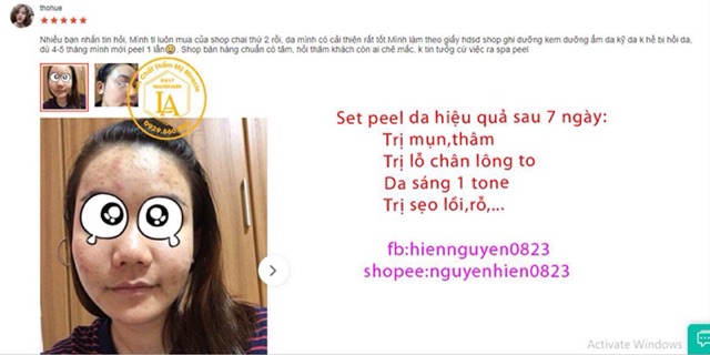 Peel TCA Zenus 50% | BigBuy360 - bigbuy360.vn