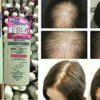 💇💇💇 COMBO Bộ Dầu gội và xả mọc tóc Kaminomoto Medicated ShampooQuy
