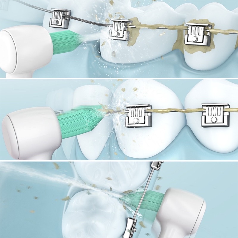 Combo Máy Tăm Nước Panasonic Ew1511 + 02 Đầu tăm Cho Người Niềng - Chính Hãng Panasonic VN