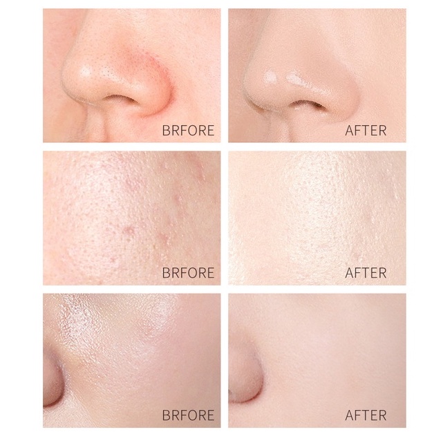 Mặt Nạ Lột Laikou Chiết Xuất Từ Ốc Sên 24k Giúp Se Khít Lỗ Chân Lông 50g Beauty City