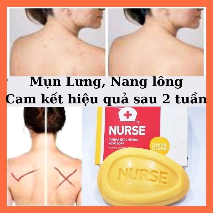 Xà Phòng Loại Bỏ Mụn Lưng Thương Hiệu NURSE Thái Lan