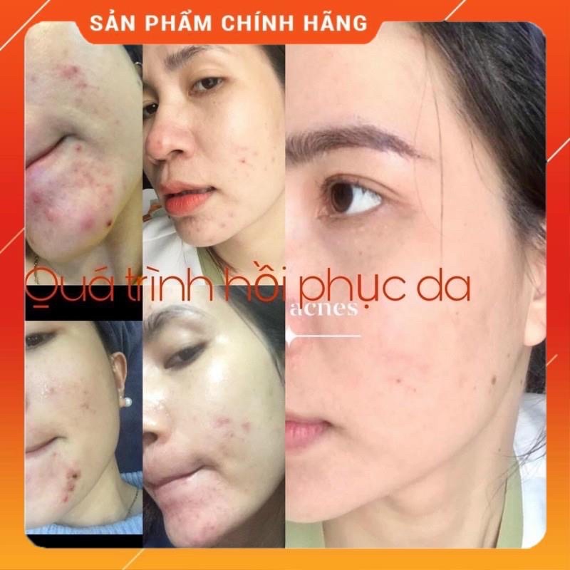 Serum đường đen Black sugar Black Sugar Nhật Bản Chính Hãng 5ml | BigBuy360 - bigbuy360.vn