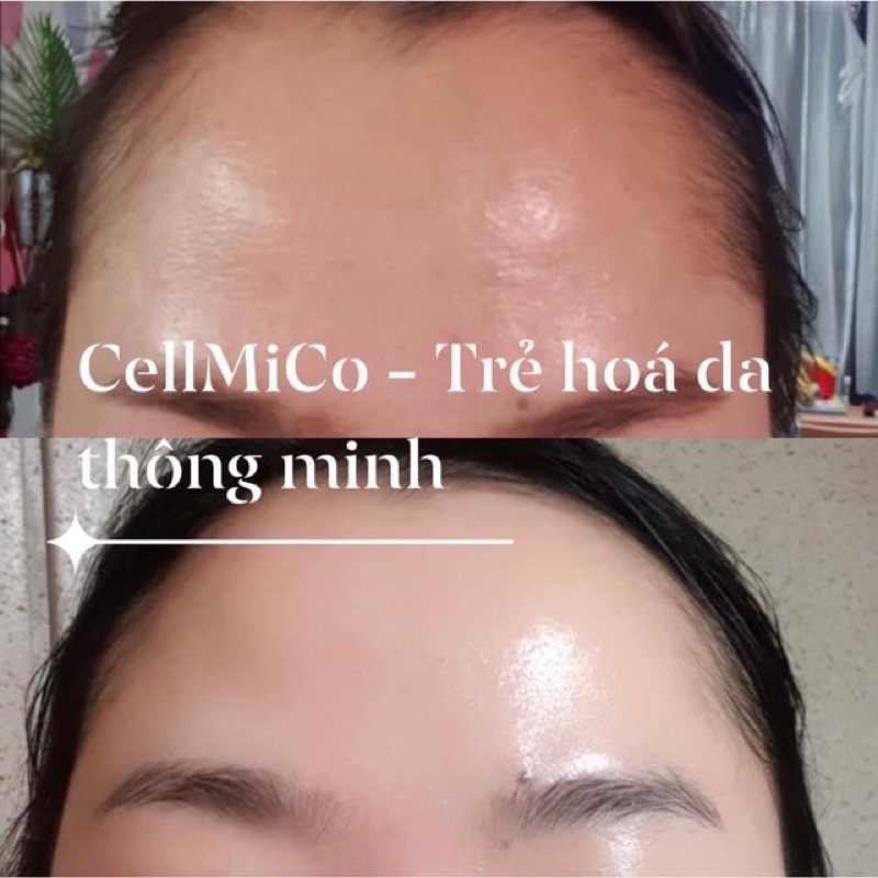 Tế Bào Gốc Vạn Năng Cellmico