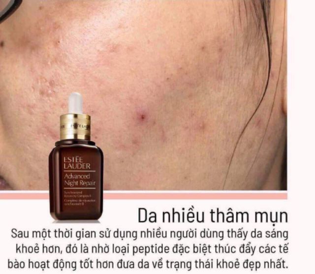 [UNBOX 30ML] TINH CHẤT PHỤC HỒI DA ESTEE LAUDER ANR MẪU MỚI2020