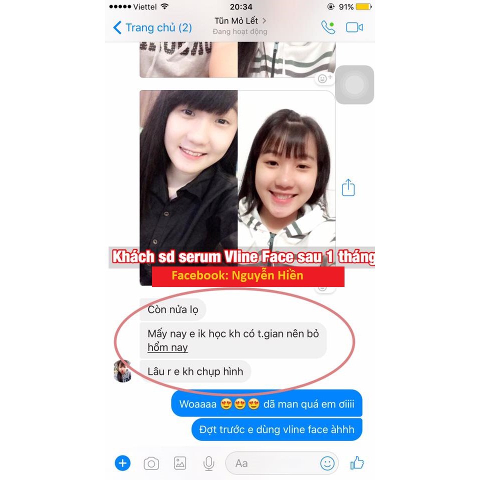 Tinh Chất Thon Gọn Mặt V-line Pháp