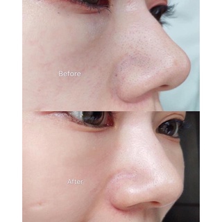 𝐓𝐨𝐧𝐞𝐫 𝐋𝐚𝐛𝐨 𝐋𝐚𝐛𝐨 100ml