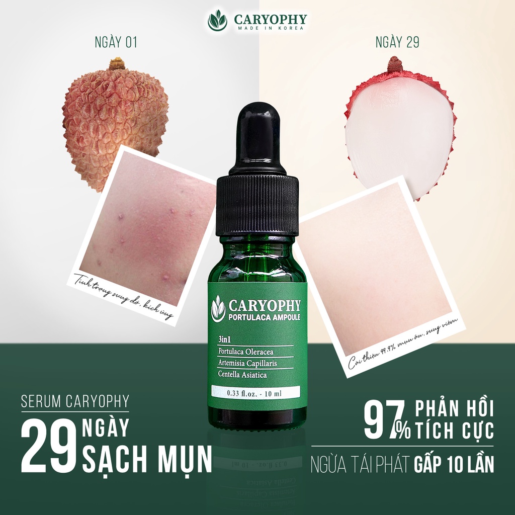 Serum mụn Caryophy cho da dầu ngăn ngừa thâm mụn mụn ẩn mụn bọc mụn trứng cá các loại mụn và thâm hàn quốc 10ml