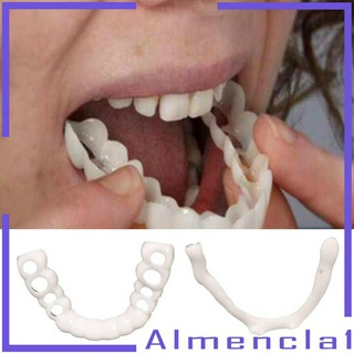 Veneers silicon mềm tạm thời giả trên