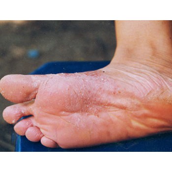 Kem bôi da nấm, ngứa,...Nội địa trung quốc - Hàng có sẵn | BigBuy360 - bigbuy360.vn