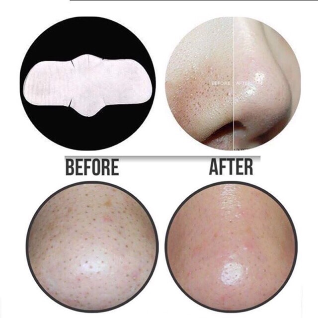 MIẾNG DÁN LỘT MỤN CIRACLE GOOD-BYE BLACKHEAD | BigBuy360 - bigbuy360.vn