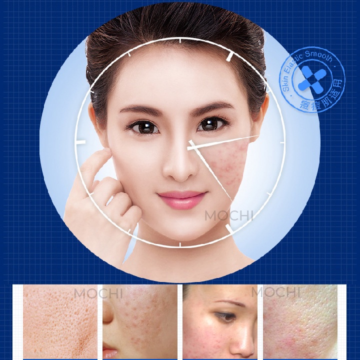 Mặt Nạ Mụn Kiềm Dầu Dưỡng Trắng Da l Cấp Ẩm Mask Giấy Đắp Mặt Acne Skin IMAGES Nội Địa Trung MOCHI SHOP