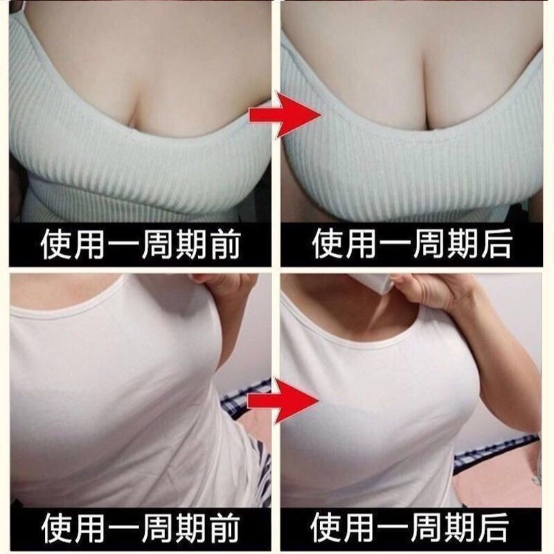 Miếng Dán Nâng Ngực Từ A Đến E pectoralis Chuyên Dụng Giúp Tăng Kích Thước Vòng Một Từ A Đến E Dành Cho Phụ Nữ Sau Sinh Size Lớn 3 11 | BigBuy360 - bigbuy360.vn