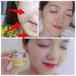 Cao Tinh Nghệ Sữa Ong Chúa Thảo Mộc 37, Chăm Sóc Da Mặt  - GIÁ GỐC | BigBuy360 - bigbuy360.vn