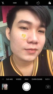 Tái tạo da Phương Anh