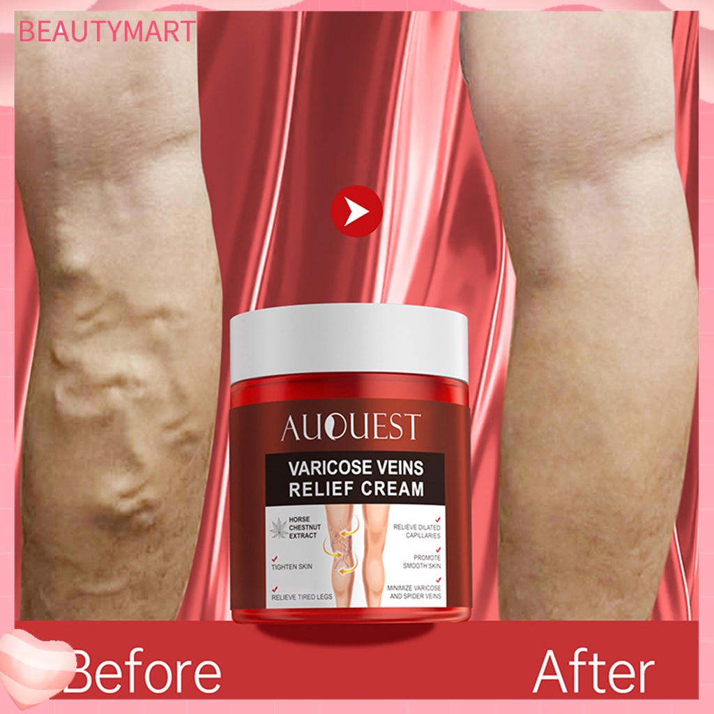 Kem Chiết Xuất Từ Gừng Tự Nhiên 80g Giúp Giảm Giãn Tĩnh Mạch Hiệu Quả