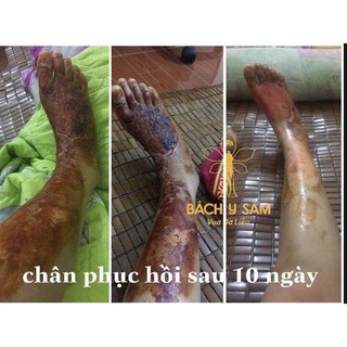 Cao sẹo Bạch Linh