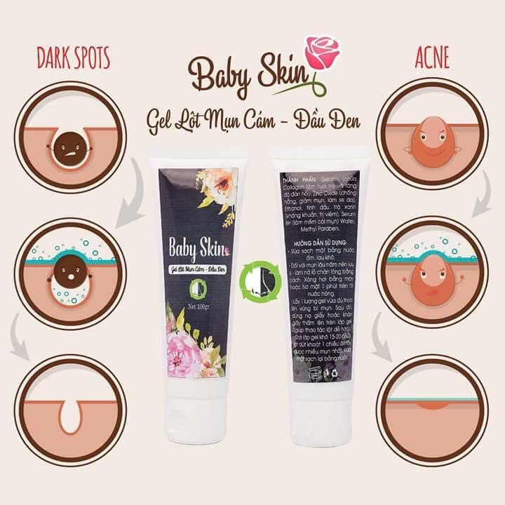 BABY SKIN - GEL LỘT MỤN TINH CHẤT SERUM BH VÀ TRÀ XANH
