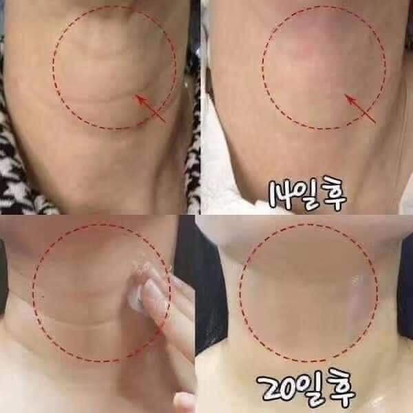 Kem dưỡng giảm nhăn vùng cổ Medipeel (Medi-peel)