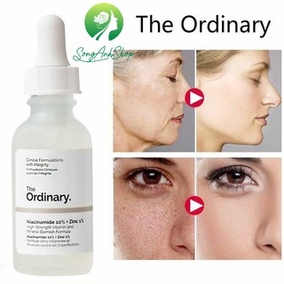 Serum Niacinamide 10% + Zinc 1% The ORDINARY Giảm Mụn, Trắng Da 30ml