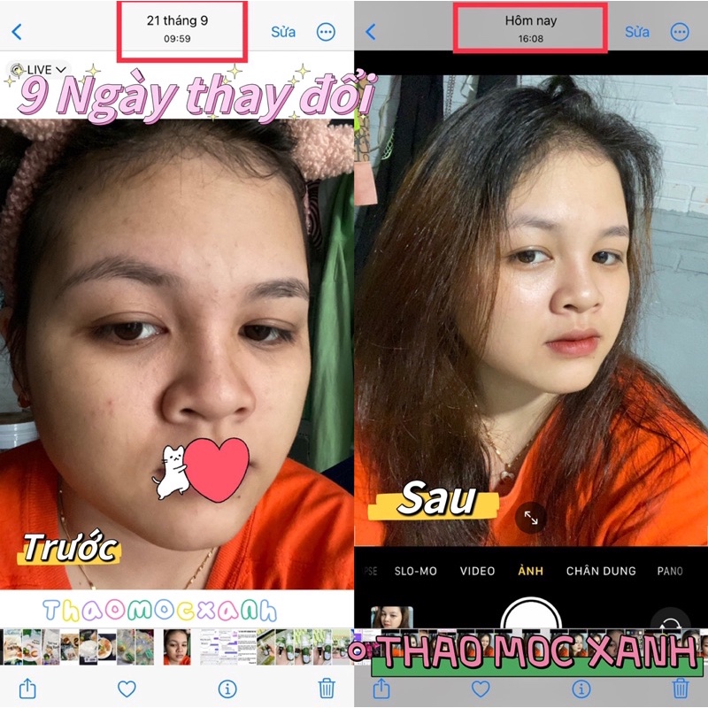 Combo thảo mộc xanh