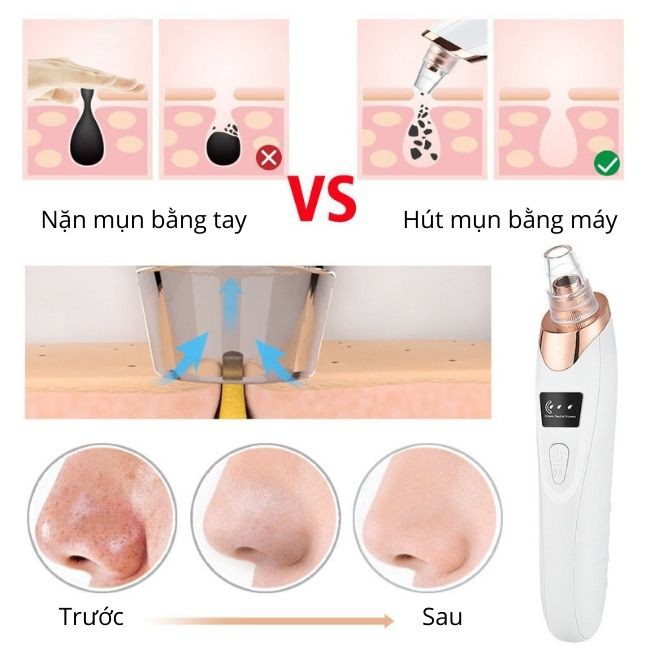 [FREESHIP] Máy Hút Mụn Cám, Đấu Đen  Cầm Tay Mini Blackhead 3 Chế Độ 5 Đầu Hút Siêu Mạnh