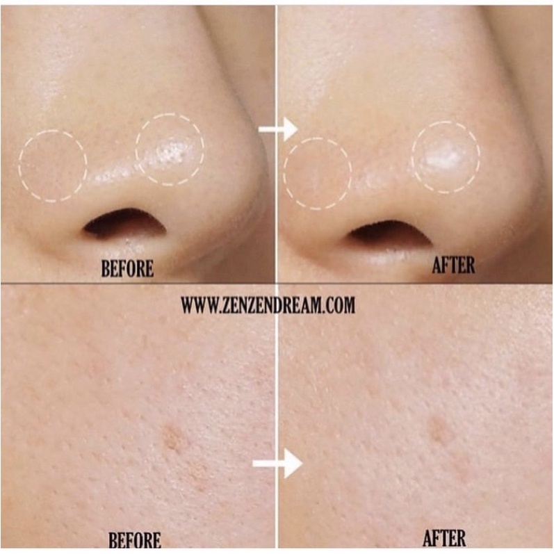 Sáp giảm mụn đầu đen INNSFREE JEJU VOLCANIC BLACKHEAD OUT BALM