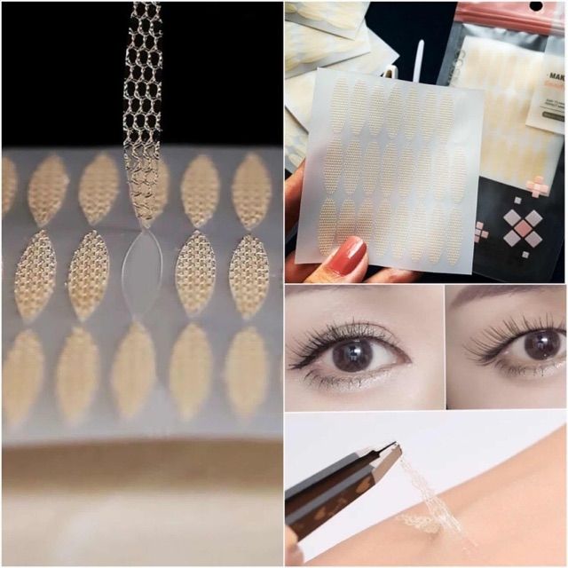 Kích mí lưới không cần dùng keo