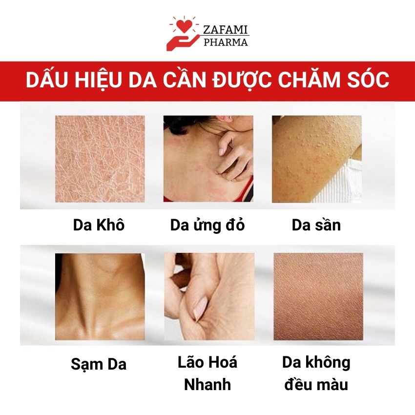 Kem dưỡng ẩm body trắng da body lotion dưỡng da dưỡng thể Fixderma Moisturizing Multi Active (150ml) Zafami Pharma | BigBuy360 - bigbuy360.vn