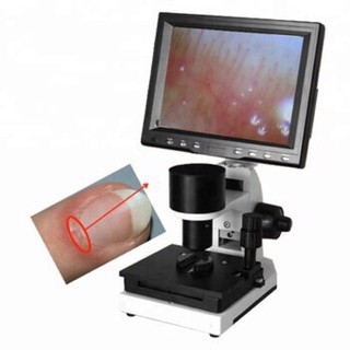 Kính hiển vi soi mạch máu