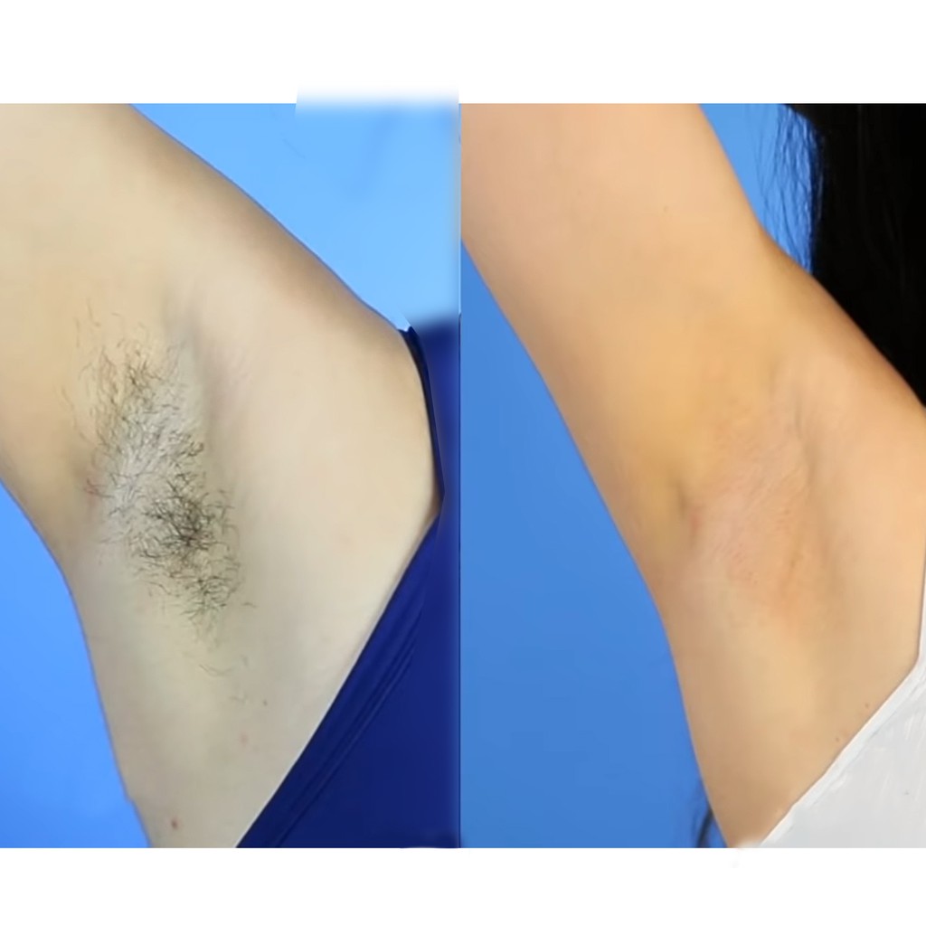 DẦU LAU SÁP THỪA SAU TẨY LÔNG TRIỆT LÔNG Alpine Bluebell NHẬP KHẨU ÚC | BigBuy360 - bigbuy360.vn