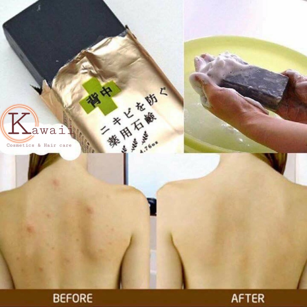 [NHẬP NHẬT] Xà phòng trị mụn lưng, ngực For Black Medicated Soap Pelican (Nội địa Nhật) | BigBuy360 - bigbuy360.vn