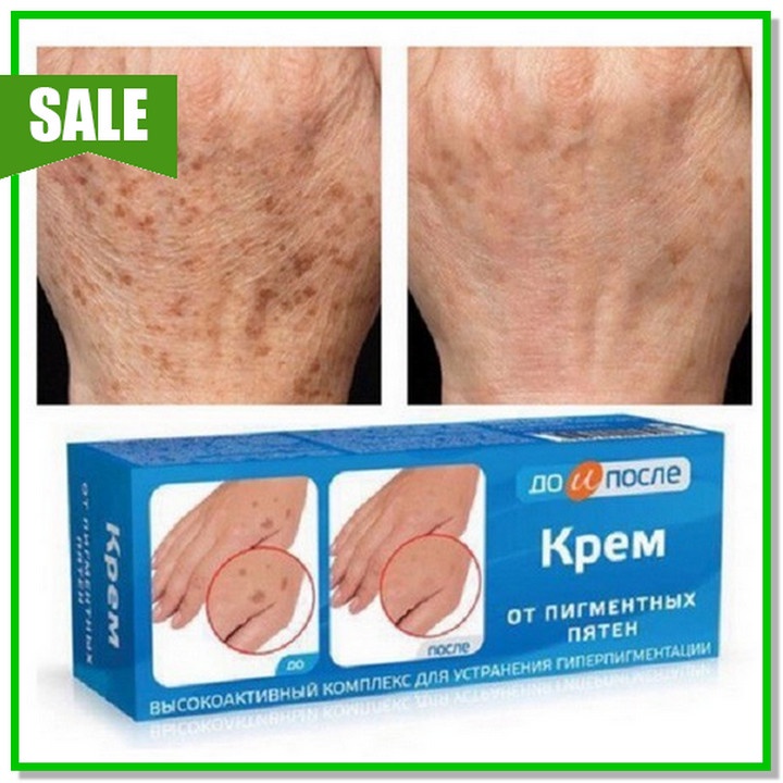 Kem Đồi Mồi Kpem 50ml Nga,⚡️FREESHIP⚡️,Mờ Nhăn Tay, Nám, Tàn Nhan, Dưỡng Da tay