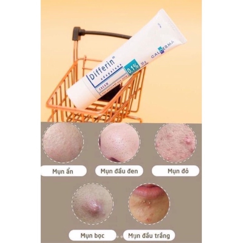 Kem bôi mụn giảm thâm Di.fferin Adapalene 0,1%