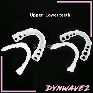 [Dynwave2] Veneer mềm trên và dưới có thể tái sử dụng giả tạm thời