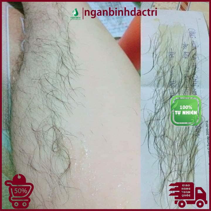 WAX LÔNG VEO Tẩy sạch MỌI VÙNG Lông + TẶNG kèm giấy wax + que gạt (Wax tẩy lông, Kem tẩy lông, Triệt lông Vĩnh viễn mới